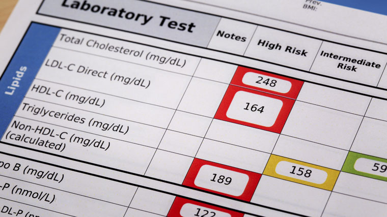 38-Cholesteral-Numbers_760x427