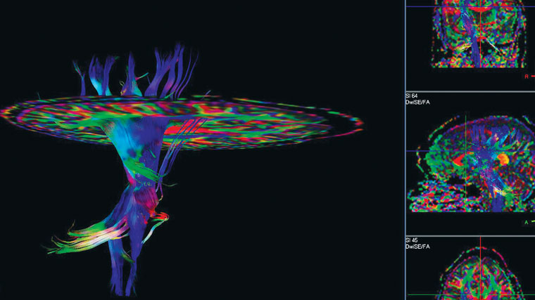 BrainMapping_760x427 BrainMapping_760x427