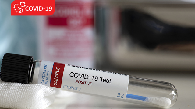 P-C-MKT03306-Coronavirus_Screening_Testing_Stckbl