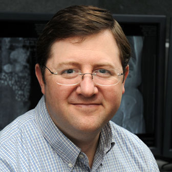 Bruce Gearhart, MD Bruce Gearhart, MD