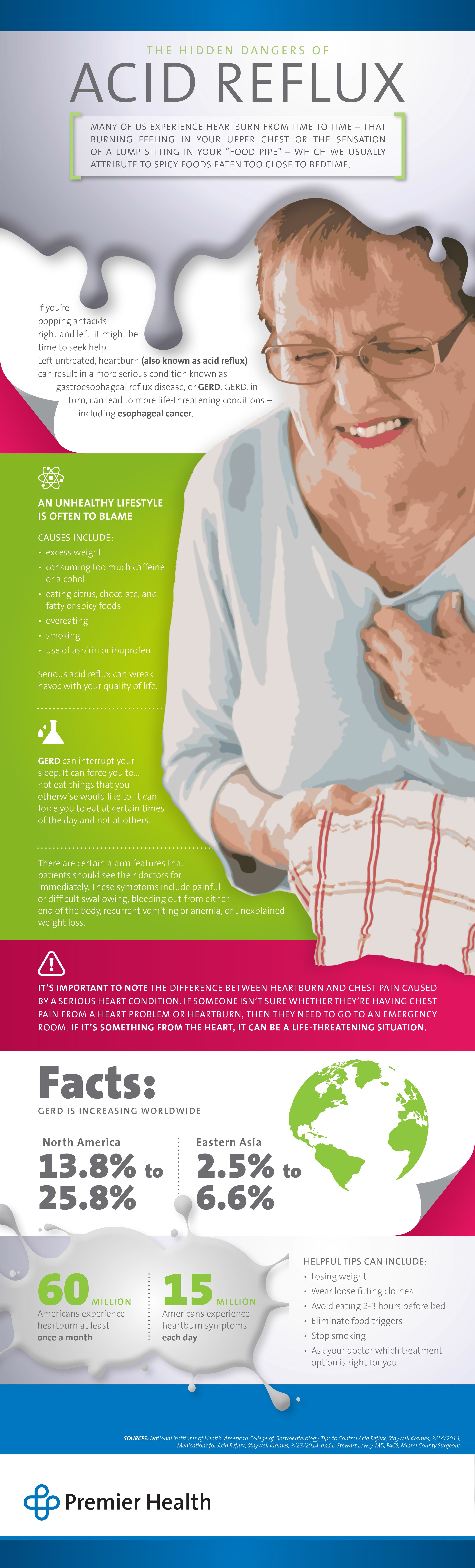 Acid Reflux - Infographic Acid Reflux - Infographic