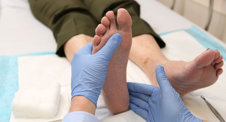 Your Aching Big Toe! What To Do For Gout | Premier Health