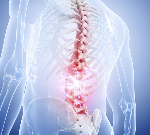 Lumbar Laminectomy small Lumbar Laminectomy small