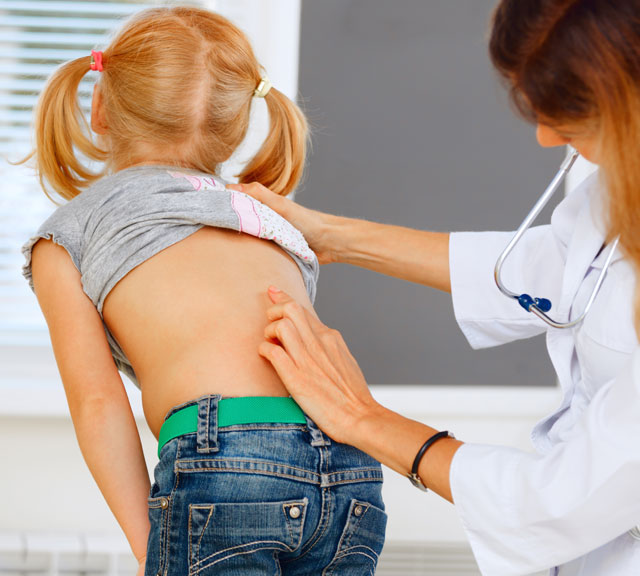 Scoliosis small Scoliosis small