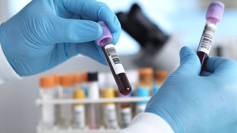 p-w-wmn92520-anemia-facts-lg