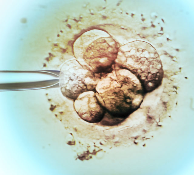 IVF Big Step small IVF Big Step small